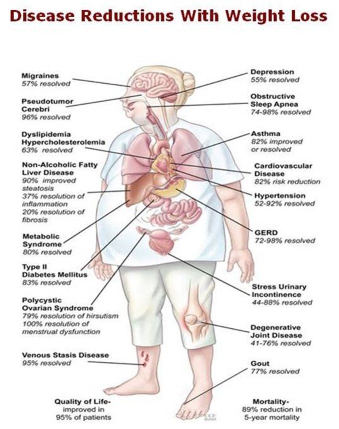 Disease Reductions with Weight Loss chart